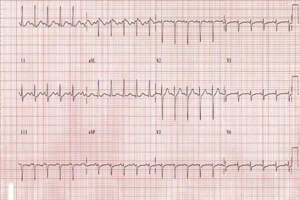 Кракен 16 вход